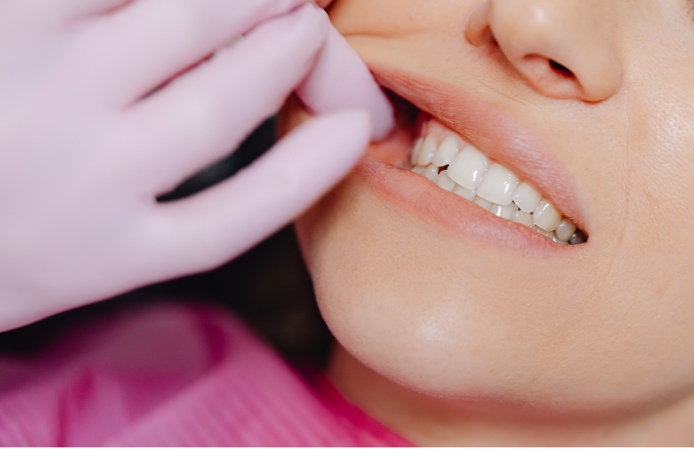 見た目の美しさとしっかり噛める噛み合わせの両立