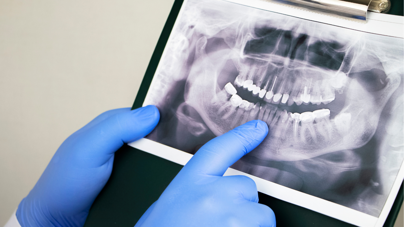 定期的なチェックと調整