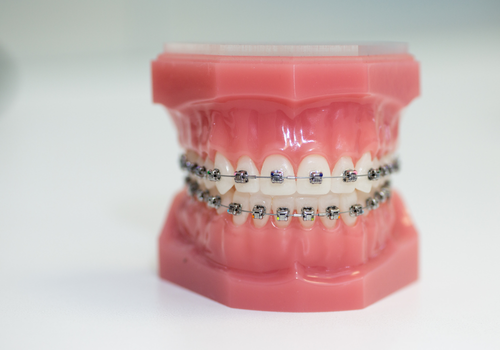 お子様の負担を抑えた装置設計