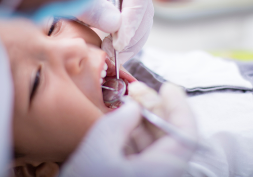 必要最小限の装置で本来の成長を促す治療